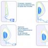 Rekonštrukcia prsníka po mastektómii